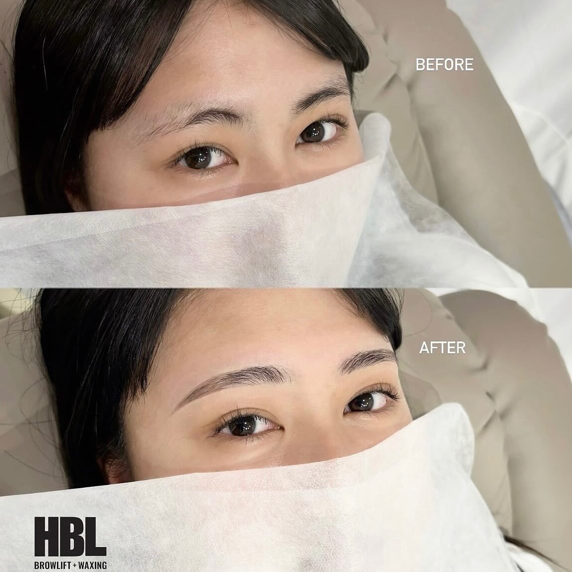 【Hollywood Brow Lift】